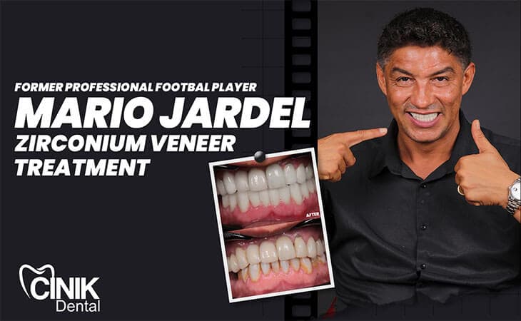 Mario Jardel